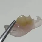 La imagen 8 de la Empresa LABORATORIO DENTAL SILGER Protesis Dentales en Mar del Plata AR-B