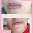 La imagen 2 de la Empresa PATRICIA AVILA- ESTETICA Tratamiento para Celulitis en Neuquén AR-Q
