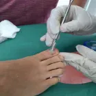 La imagen 2 de la Empresa PODOLOGIA Y ESTÉTICA EN GRAL Uñas Encarnadas en Villa Mercedes AR-D