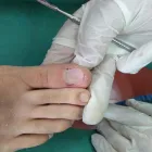 La imagen 3 de la Empresa PODOLOGIA Y ESTÉTICA EN GRAL Uñas Encarnadas en Villa Mercedes AR-D