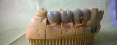 La imagen 3 de la Empresa ODONTOLOGIA PRIVADA INTEGRAL OPAT Tratamiento Endodontico en Capital Federal AR-B