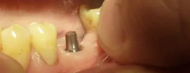 La imagen 6 de la Empresa ODONTOLOGIA PRIVADA INTEGRAL OPAT Tratamiento Endodontico en Capital Federal AR-B