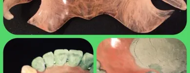 La imagen 3 de la Empresa STUDIO DENTAL-INSTITUTO DE ENSEÑANZA Y CAPACITACIÓN - MECÁNICOS DENTALES. Tratamiento Endodontico en Capital Federal AR-B