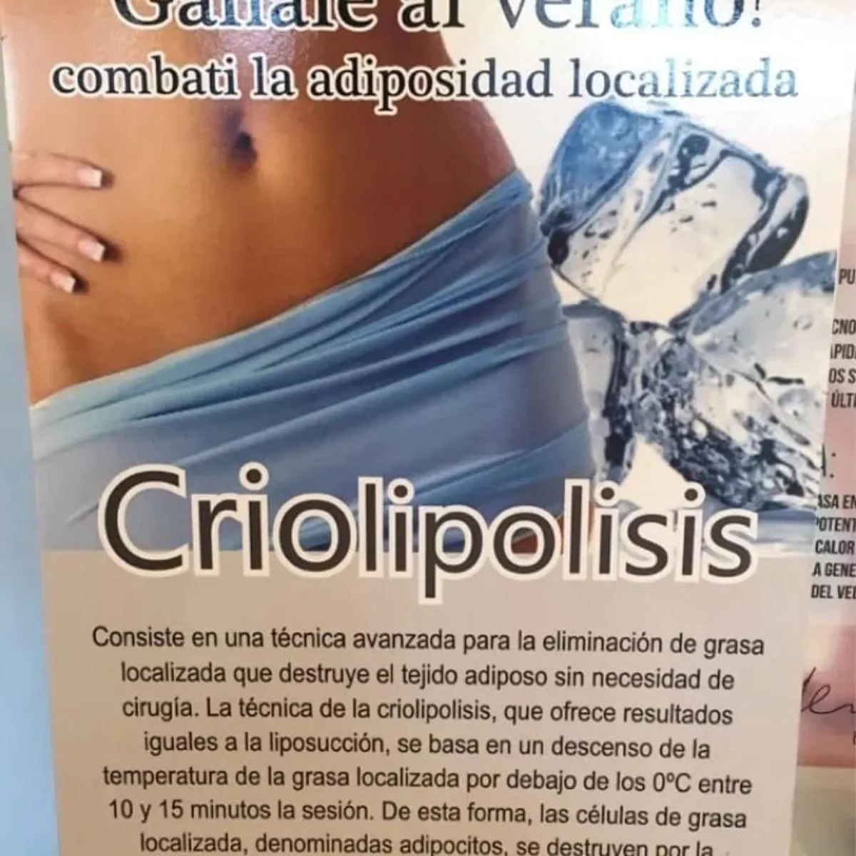 La imagen 2 de la Empresa AINE DEPILACION DEFINITIVA