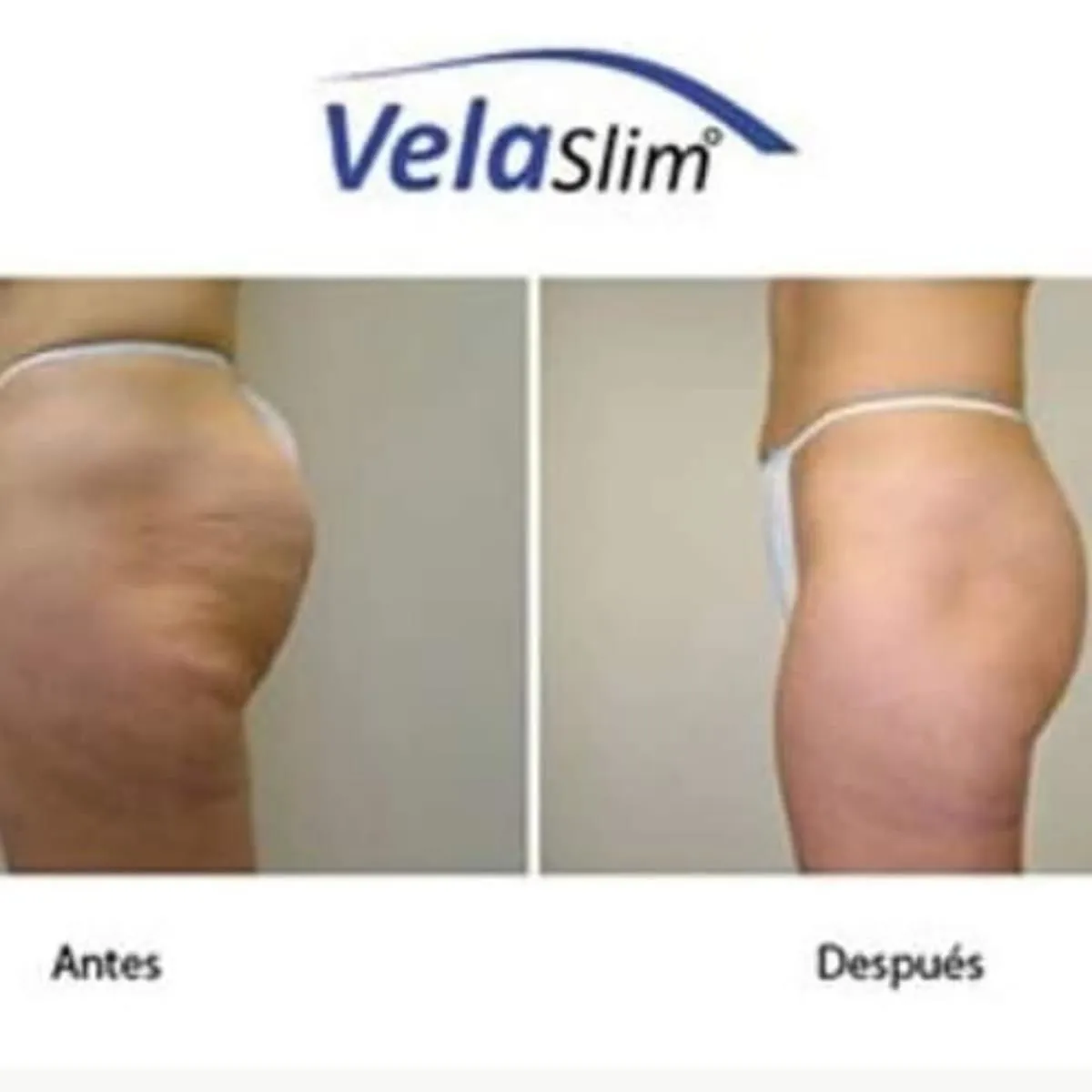 La imagen 3 de la Empresa AINE DEPILACION DEFINITIVA